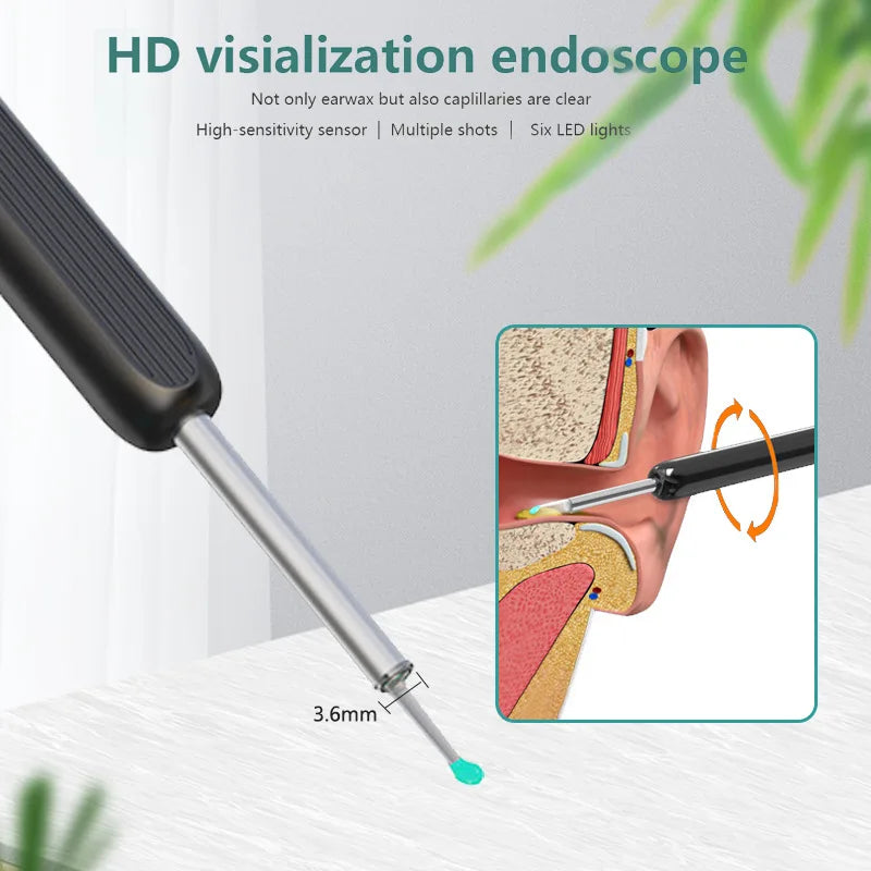Smart Visual Ear Sticks - High Precision Wax Removal Ear Cleaner - Mad Vits