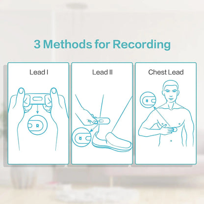 Pocket ECG Monitoring Device with Bluetooth EKG Monitor for iOS/Android