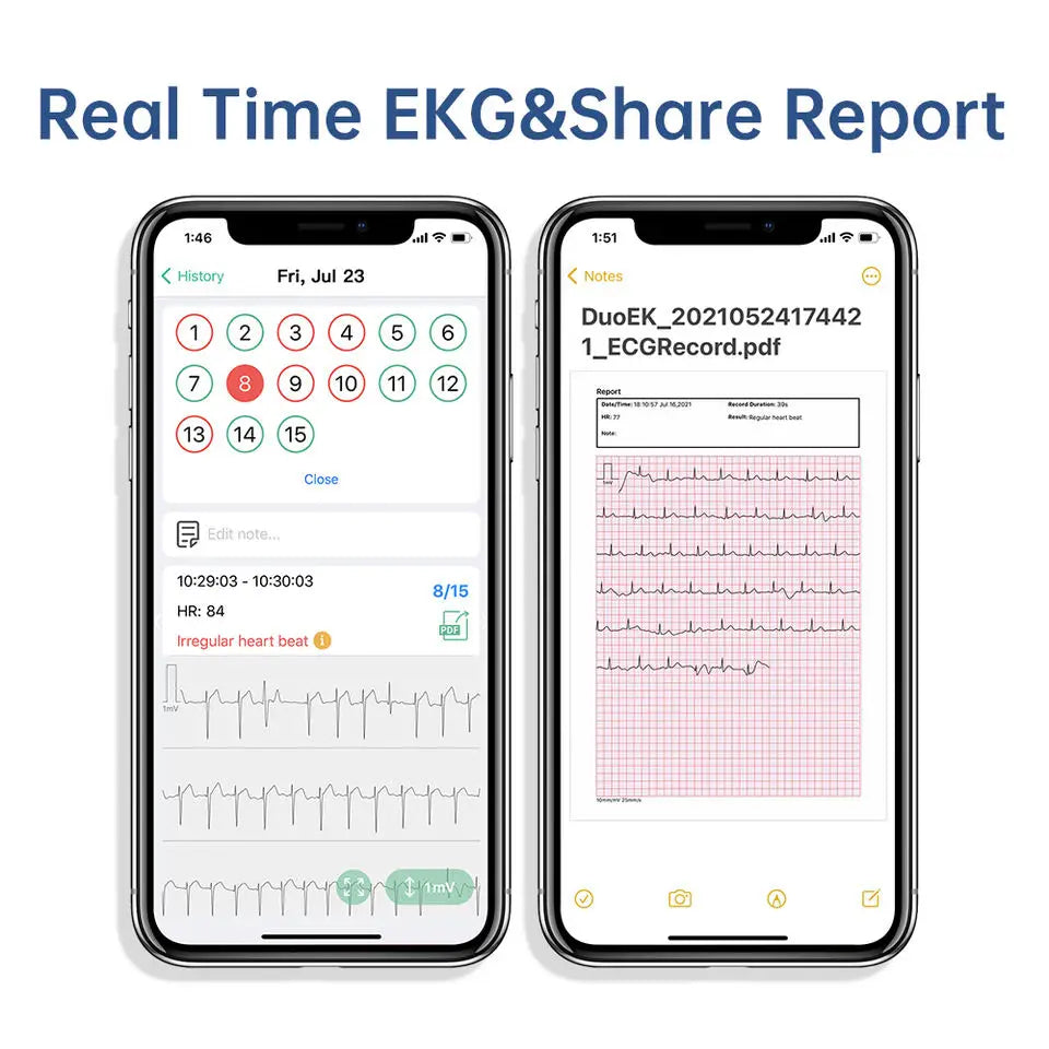 Pocket ECG Monitoring Device with Bluetooth EKG Monitor for iOS/Android