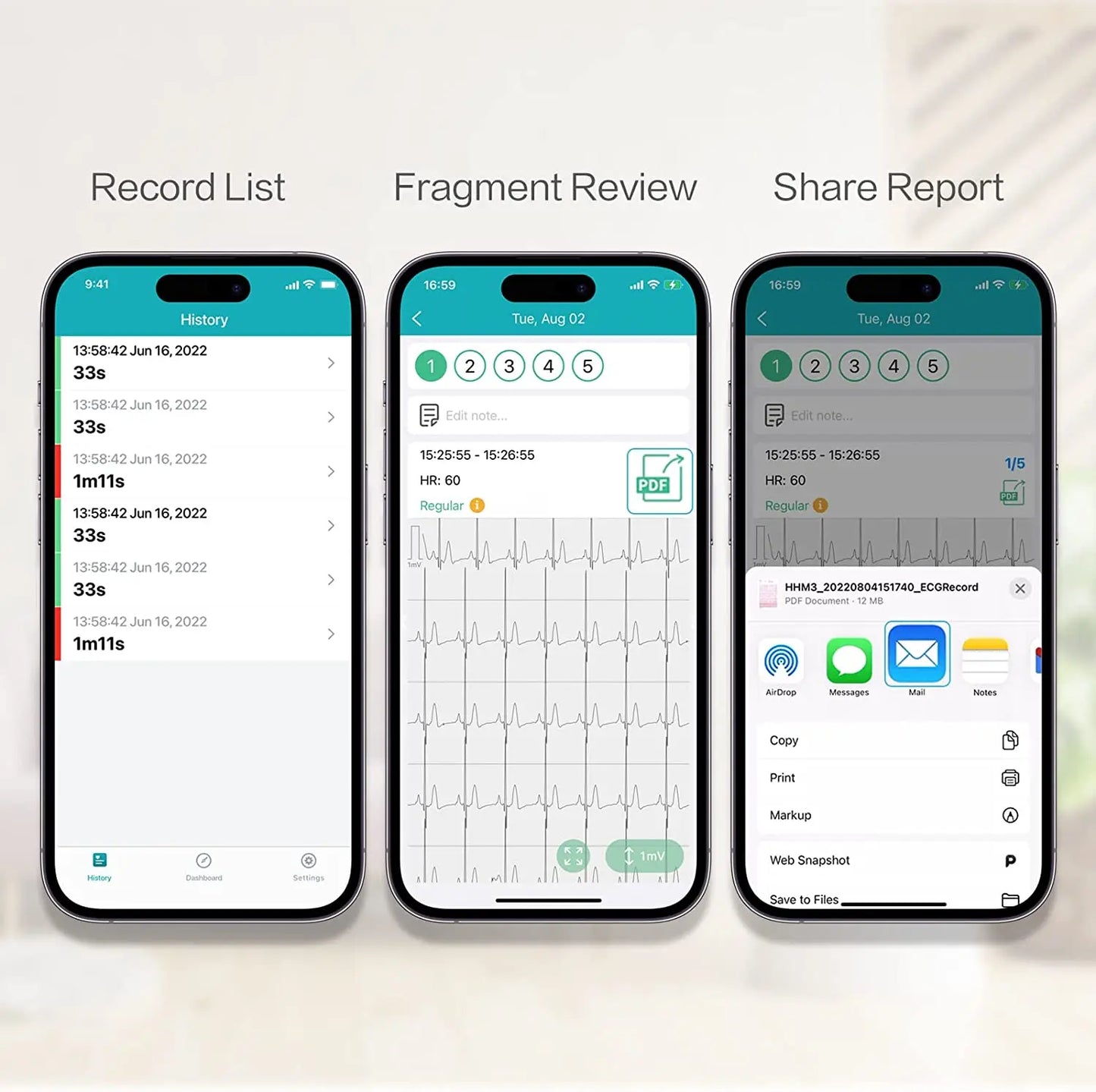 Pocket ECG Monitoring Device with Bluetooth EKG Monitor for iOS/Android