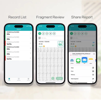 Pocket ECG Monitoring Device with Bluetooth EKG Monitor for iOS/Android